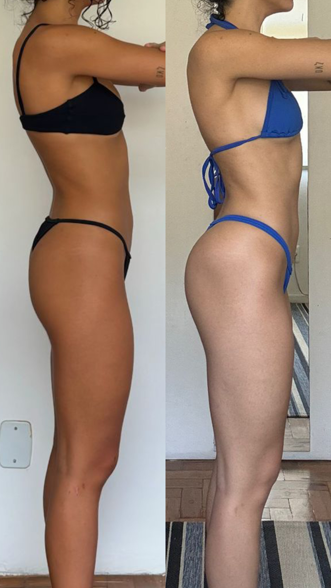 ANTES E DEPOIS 3