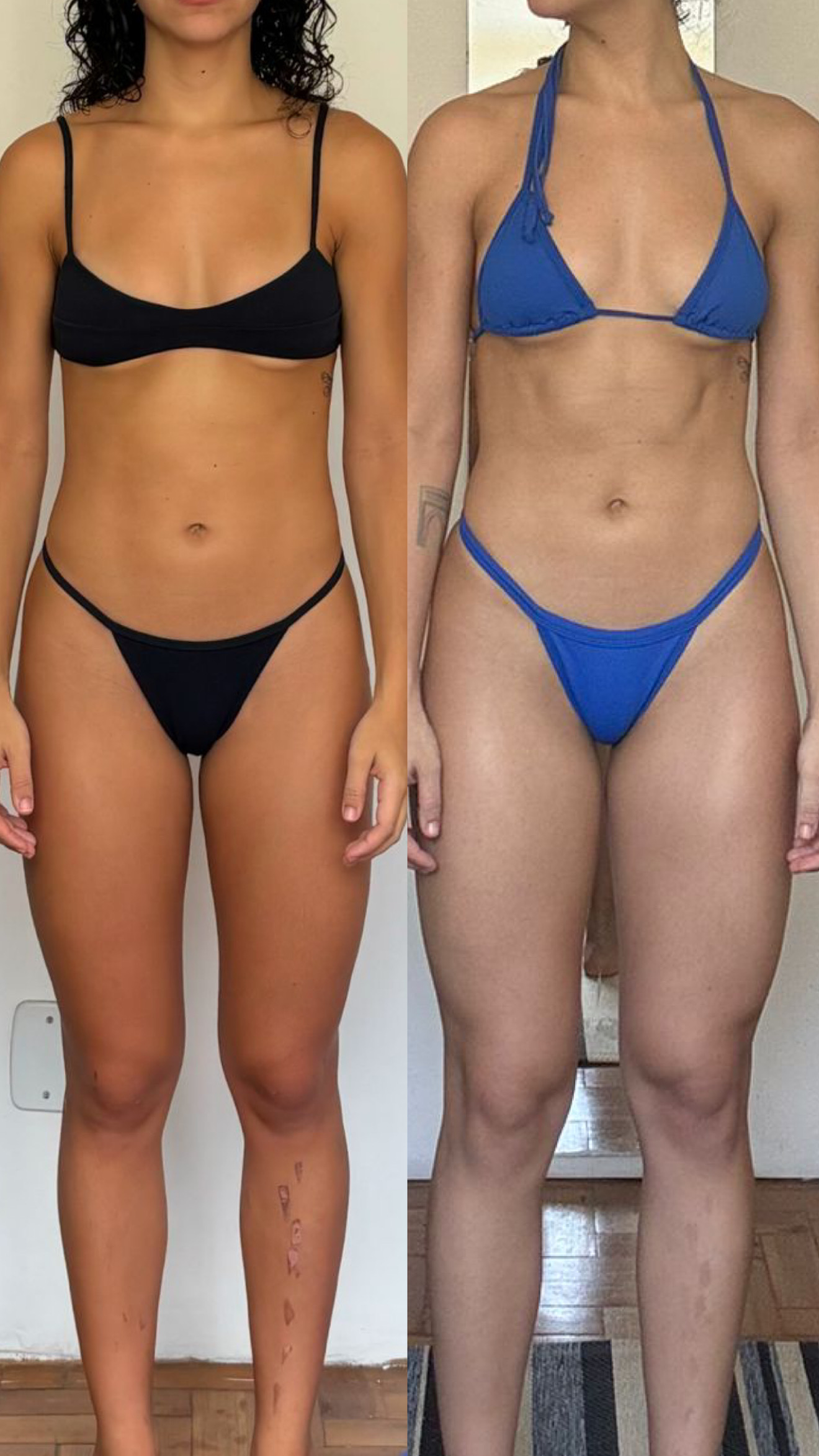 ANTES E DEPOIS 4